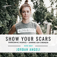 Show Your Scars