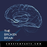 The Broken Brain