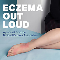 Eczema Out Loud
