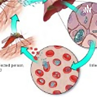 Causes Of Malaria Podcast