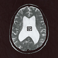 Headless Youth Podcast