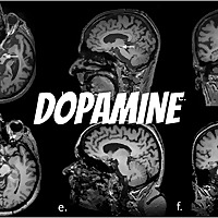DOPAMINE