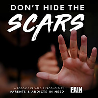 Don't Hide The Scars. Presented By PAIN: Parents & Addicts In Need