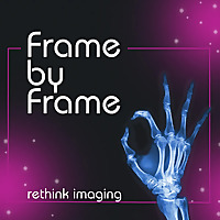 Frame by Frame: Rethink Imaging