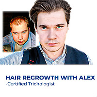 Hair Loss Solutions That Work   2025 Breakthroughs