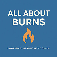All About Burns